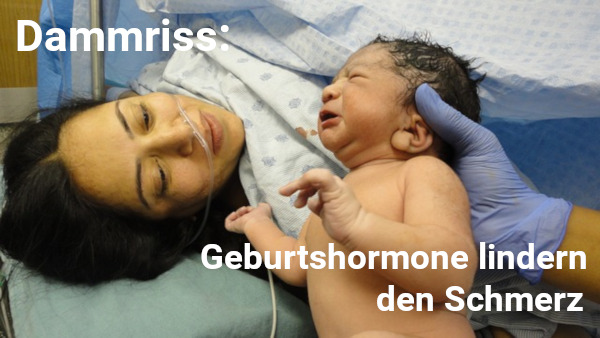Dammriss – Hormone bei der Geburt lindern den Schmerz Bild: Dammriss - Hormone bei der Geburt lindern den Schmerz