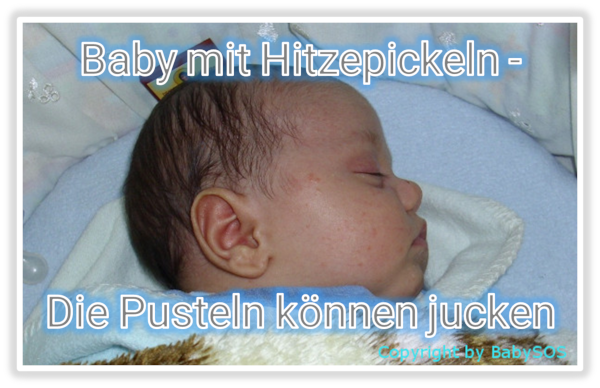 Milien Beim Baby Was Hilft Gegen Griesskorner Bei Babys